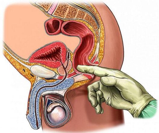 Diagnostika prostatitídy