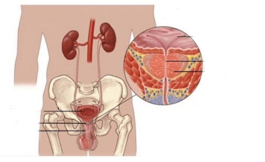 prostatitída u mužov